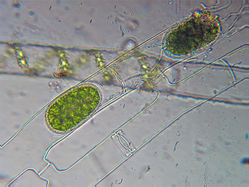 Coniugazione di Spirogyra